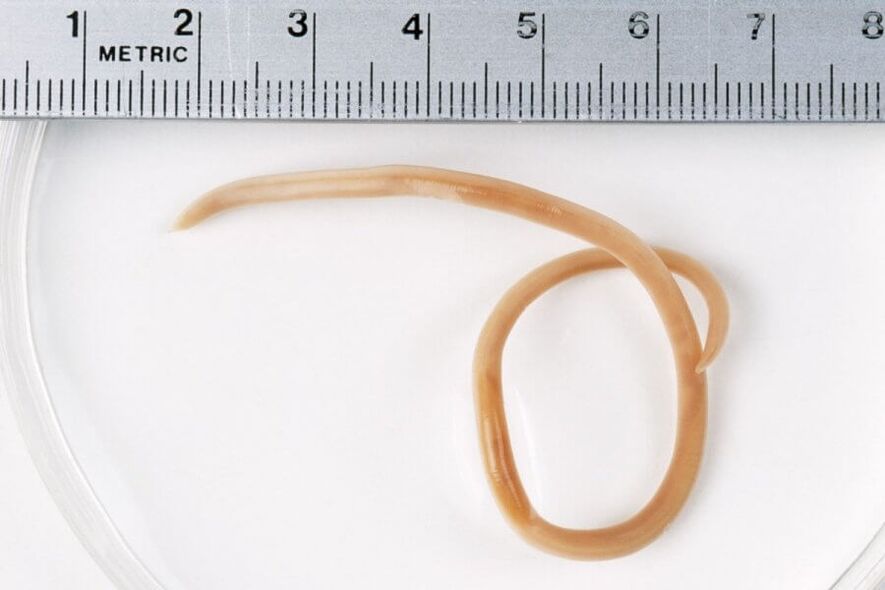 Pinworm από το ανθρώπινο σώμα