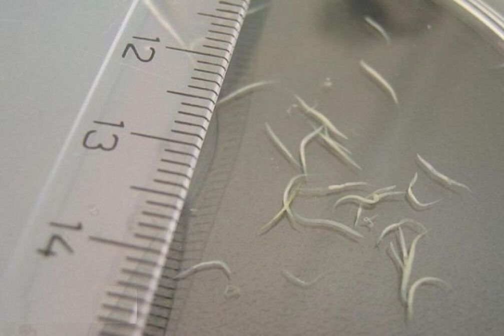 Pinworms από το ανθρώπινο σώμα