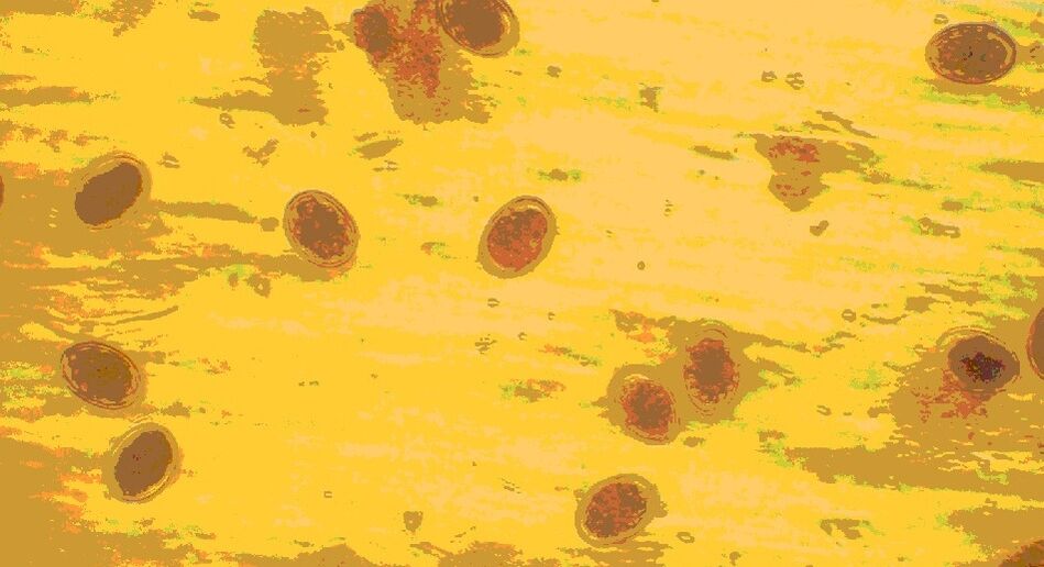 Αυγά σκουληκιών κάτω από το μικροσκόπιο