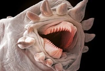 Ποια σκουλήκια μπορούν να ζήσουν στο ανθρώπινο σώμα