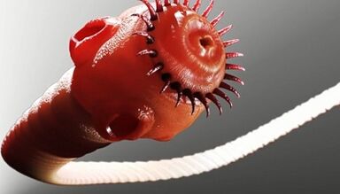 Τύποι παρασίτων στο ανθρώπινο σώμα