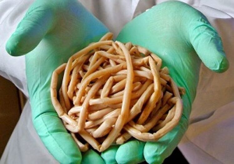 Παρασιτικά σκουλήκια από το ανθρώπινο σώμα